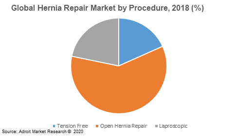 Global Hernia Repair Market by Procedure, 2018 (%) 